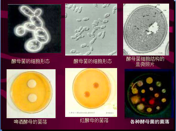 常见微生物菌落形态及消毒灭菌方式(图19)