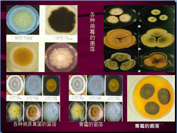 常见微生物菌落形态及消毒灭菌方式(图17)